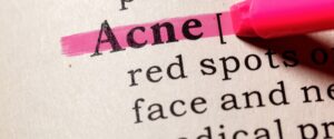 Une carence en fer peut donner de l’acné